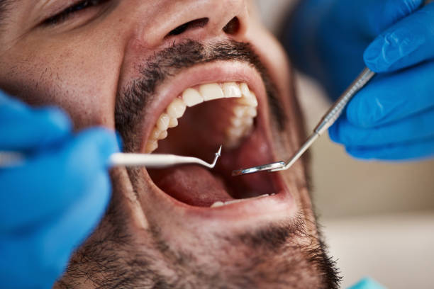 Best Knocked-Out Tooth Emergency  in East Griffin, GA